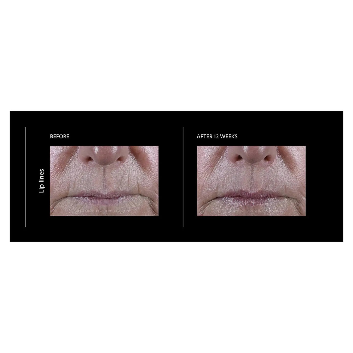 ExLinea® Pro Peptide Serum