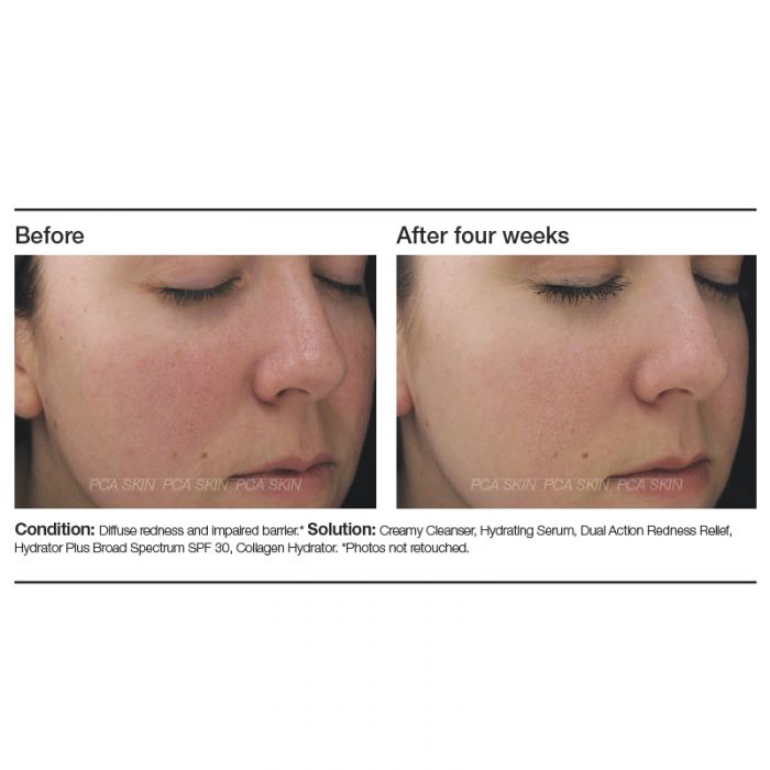 Dual Action Redness Relief