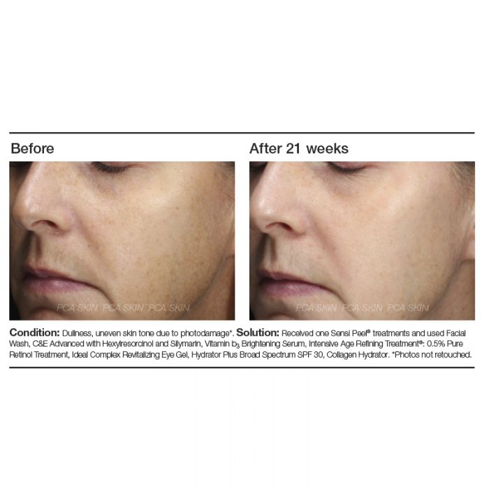 Vitamin B3 Brightening Serum (1 fl. oz.)